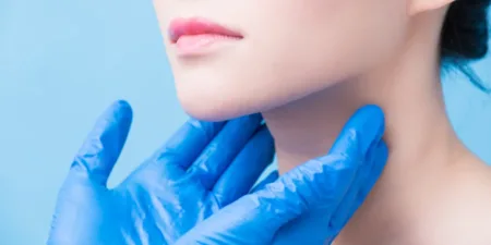 Causas, síntomas y tratamiento del hipotiroidismo - AdobeStock