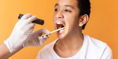 ¿Qué es la amigdalitis y cómo tratarla? - tonsillitis