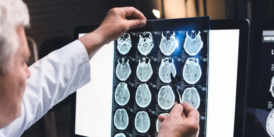 Tipos de dolores de cabeza y cómo obtener un diagnóstico - trauma headache