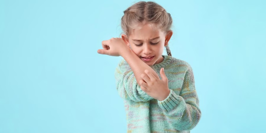 Lo que necesita saber sobre las picaduras de pulgas - flea bites