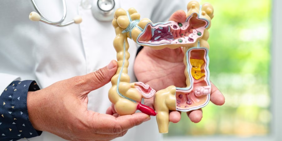 8 Beneficios para la salud del vinagre de manzana avalados por la ciencia - acv gut health 8 Beneficios para la salud del vinagre de manzana avalados por la ciencia - acv gut health