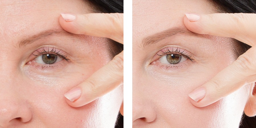 Los beneficios más importantes de tomar suplementos de colágeno - collagen skin